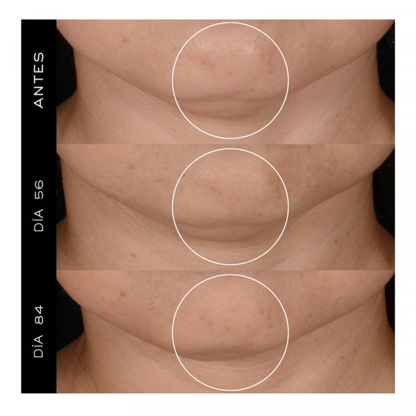 کرم ضد لک و رفع خطوط، سفتکننده و جوانساز لانکوم