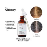 The Multi-Peptide Serum by The Ordinary is a scientifically advanced solution for boosting hair density and thickness. Featuring cutting-edge technologies like Redensyl™ and CAPIXYL.