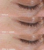 نمای نزدیک از تکسچر کرم دور چشم شیسیدو بنفیانس روی پوست اطراف چشم