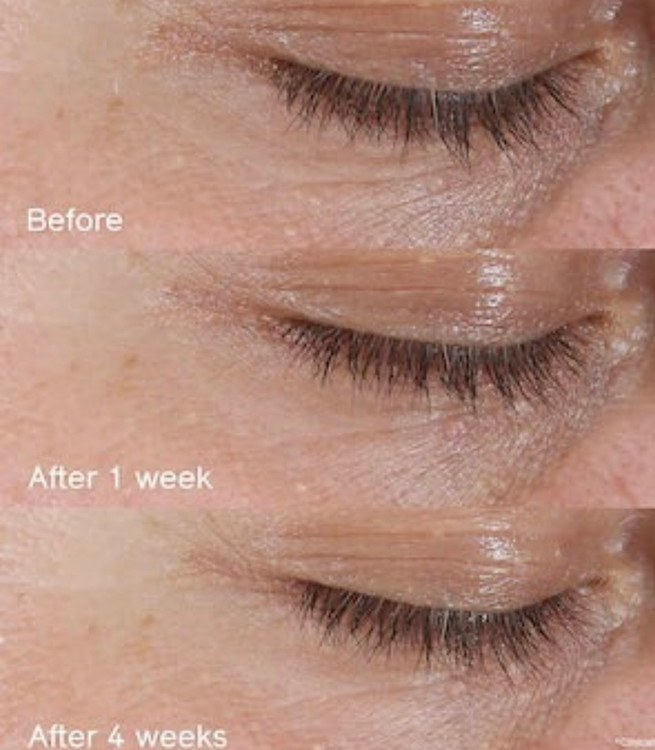 نمای نزدیک از تکسچر کرم دور چشم شیسیدو بنفیانس روی پوست اطراف چشم