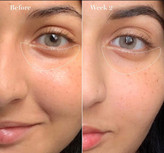 استفاده منظم این کرم چروک و خطوط سطحی محو شده با استفاده منظم جوانتر و شاداب میشه